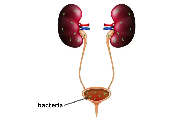 disease image