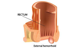 disease image